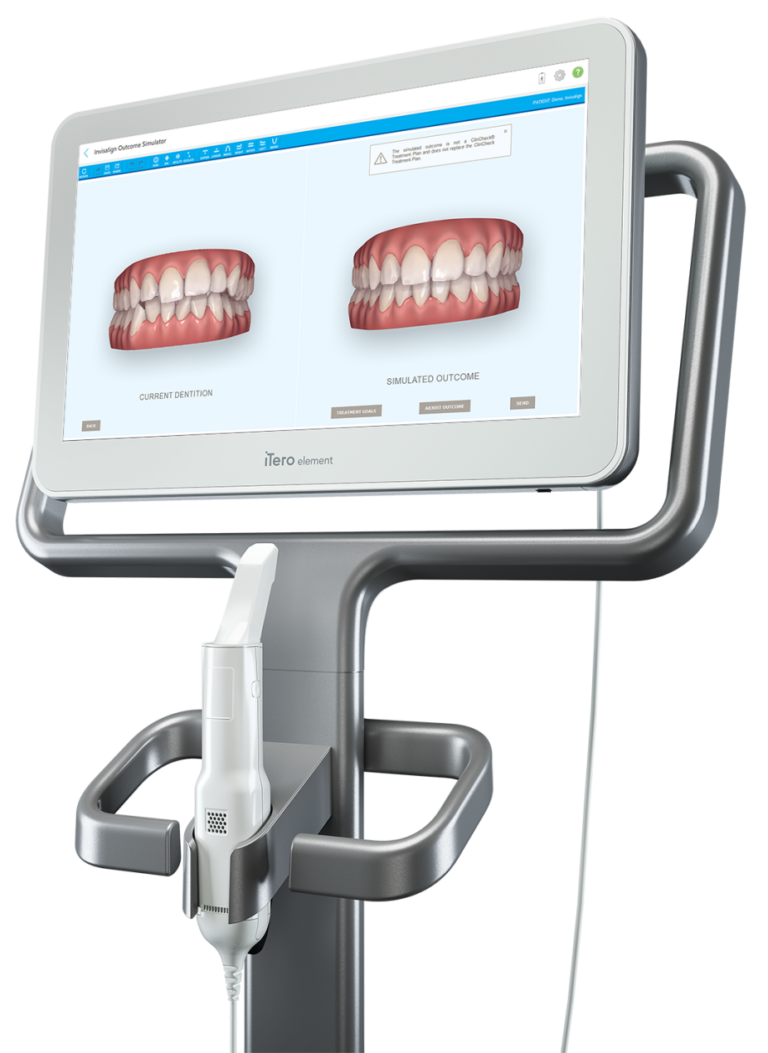 Itero Element 2 Scanner Braces Airdrie Orthodontist Airdrie