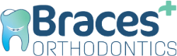 bracesplus Logo